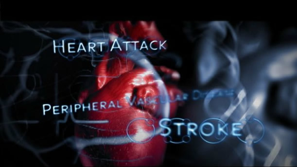 Heart Attack / Stroke - Asheville Functional Medicine
