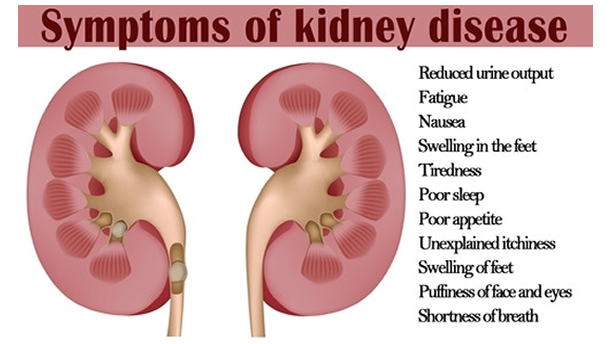 Kidney Disease - Asheville Functional Medicine